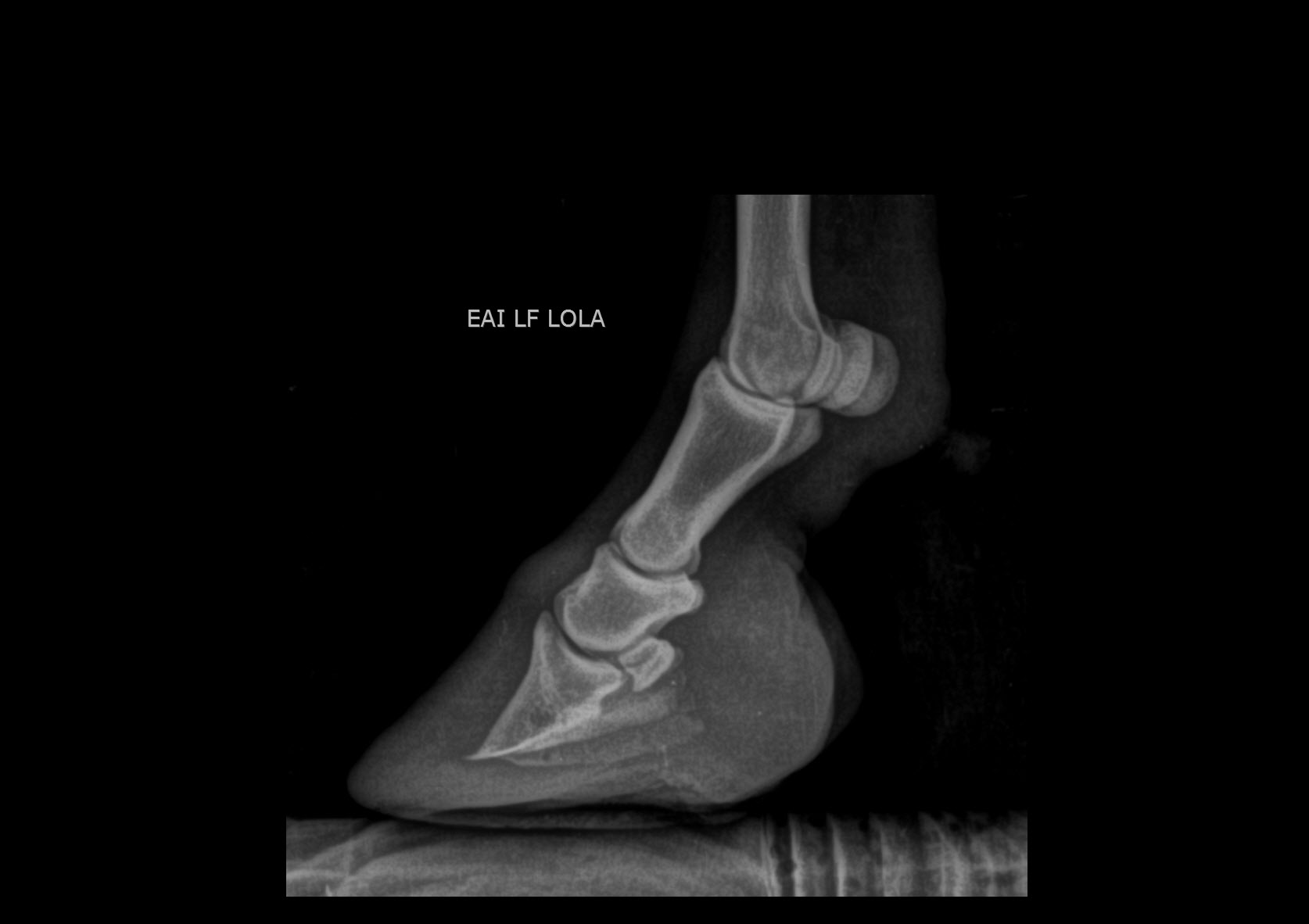 Initial lateromedial radiograph of Lola's left front hoof with chronic laminitis