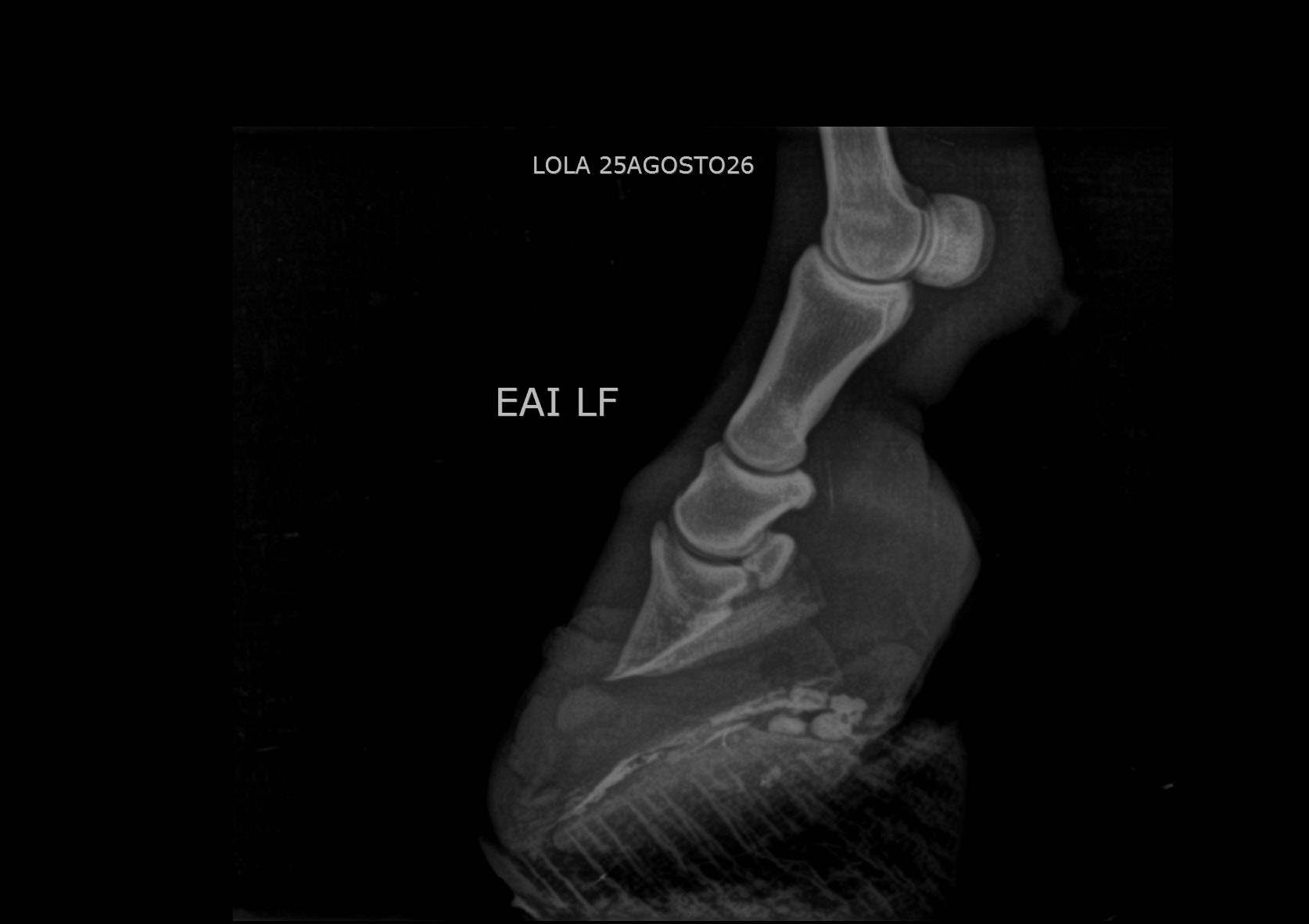 Follow-up radiograph of Lola's left front hoof with the 3D-printed laminitis horseshoe