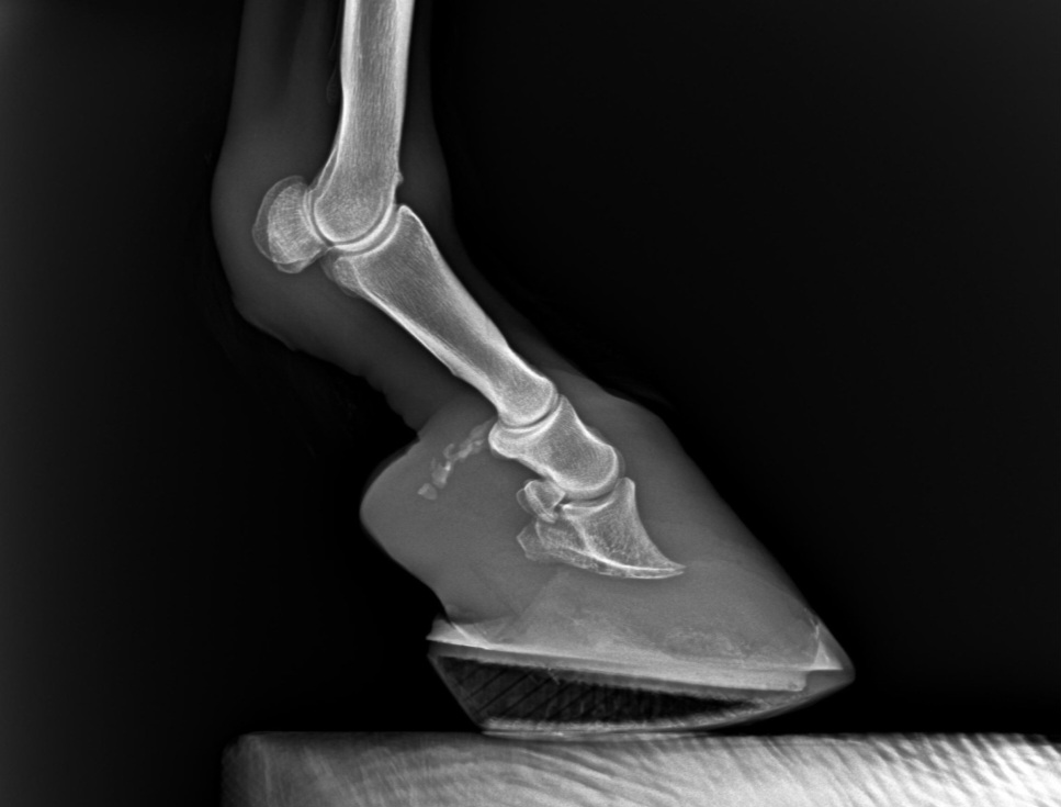 May radiograph after months in Apex horseshoes for laminitis: regrown sole and better coffin bone alignment