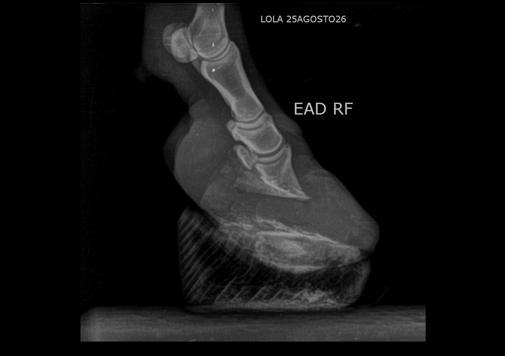 Follow-up radiograph of Lola's right front hoof with the 3D-printed laminitis horseshoe fitted