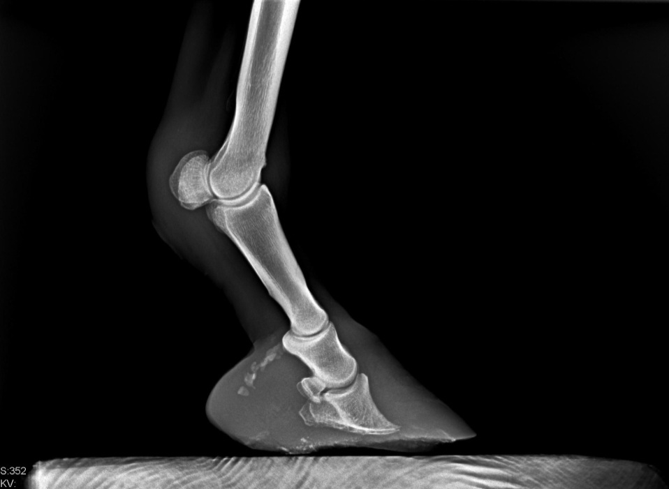 Baseline radiograph of a laminitic hoof with a thin sole and coffin bone rotation before treatment