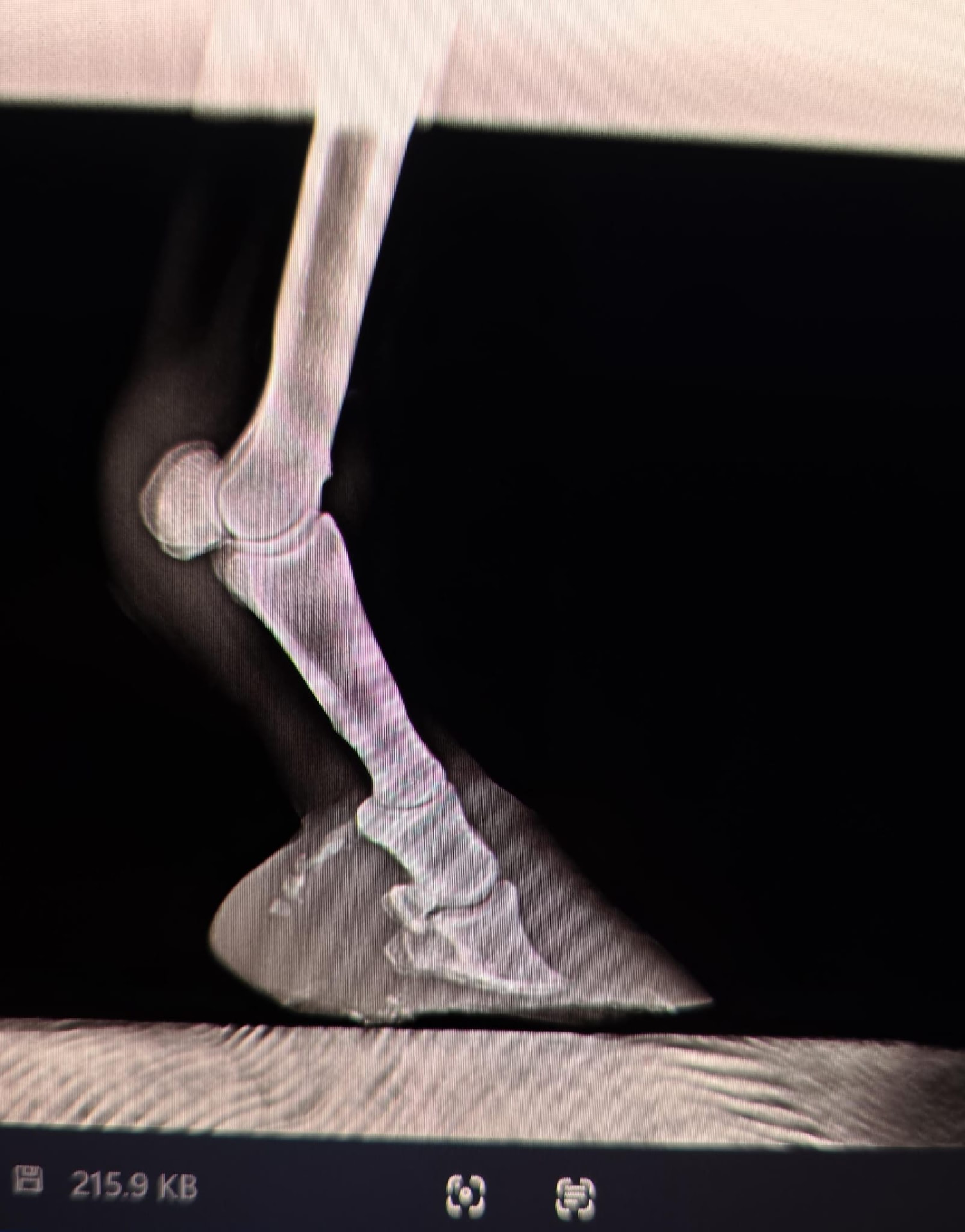 Lateromedial radiograph of Rita, a donkey with chronic laminitis, in January 2026 before the 3D horseshoe